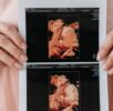 Jak przebiega rozwój prenatalny dziecka?